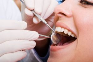 Dental Insurance in San Diego, Encinitas, CA.